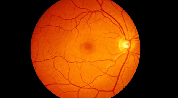 Healthy Retina