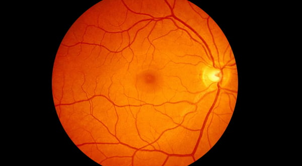 Healthy Retina