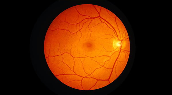 Healthy Retina